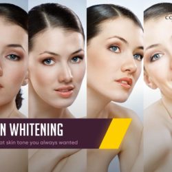 Skin Whitening Treatment in Delhi