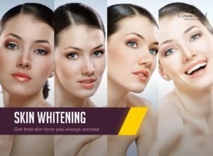 skin treatment delhi Skin Lightening with Treatment Experience Glowing Skin