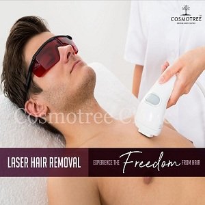 Laser Hair Removal in Delhi